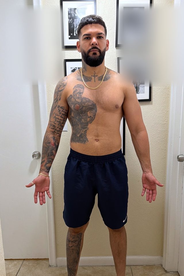 Jimmy después de 4 meses: alrededor de 40 lb menos.